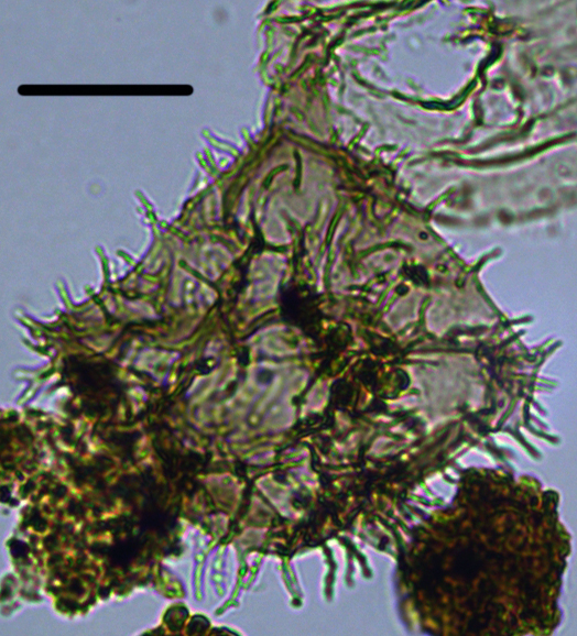 Apectodinium parvum PApar27X31011031701103a.jpg